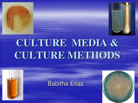 PPT - CULTURE MEDIA & CULTURE METHODS PowerPoint Presentation, free ...