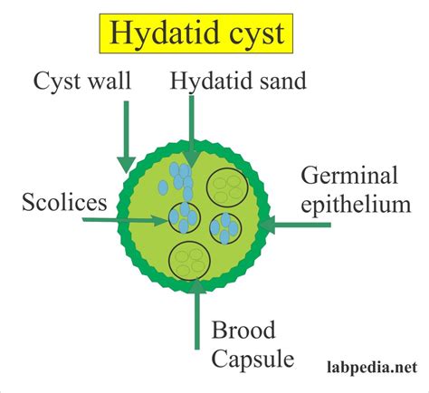 Echinococcus Granulosus Hydatid Sand