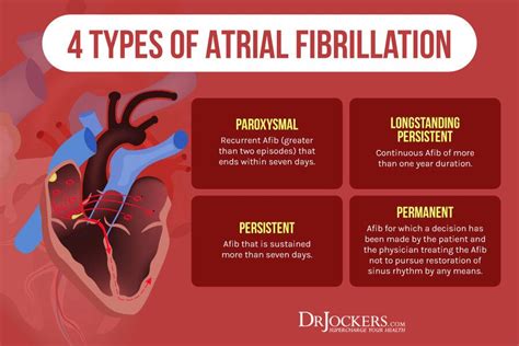 Atrial Fibrillation: Causes, Symptoms & Natural Support Strategies ...