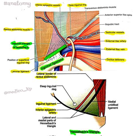 Iliopubic Tract Vs Inguinal Ligament