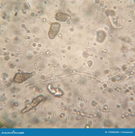 Alternaria Fungal Spores Under The Microscope Stock Image ...