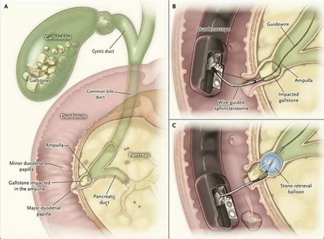 Pin by Harold Siquian on Medicine_Gastro | Medical knowledge, Medical ...