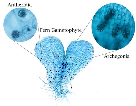 ‎Fern gametophyte with archegonia and antheridia - UWDC - UW-Madison ...