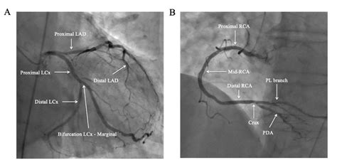 Coronary angiography - Centre de Cardiologie Interventionnelle Belledonne