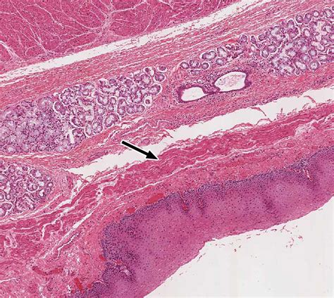 Pharynx, Esophagus, and Stomach | histology