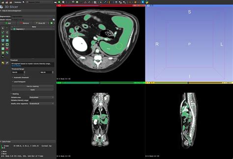 3D model not showing - Support - 3D Slicer Community