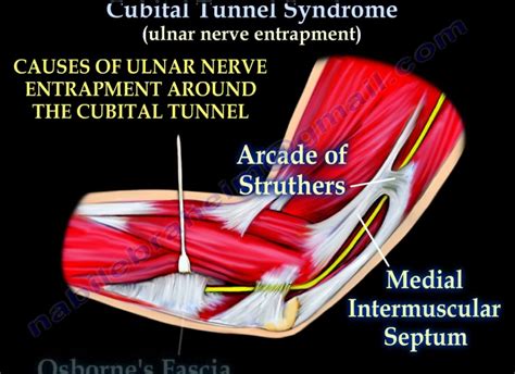 Cubital Tunnel Syndrome — OrthopaedicPrinciples.com