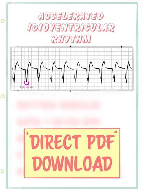 Accelerated Idioventricular Rhythm: PDF Pocket Guide | Etsy