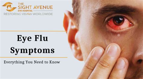 Eye Flu Symptoms: Everything You Need to Know