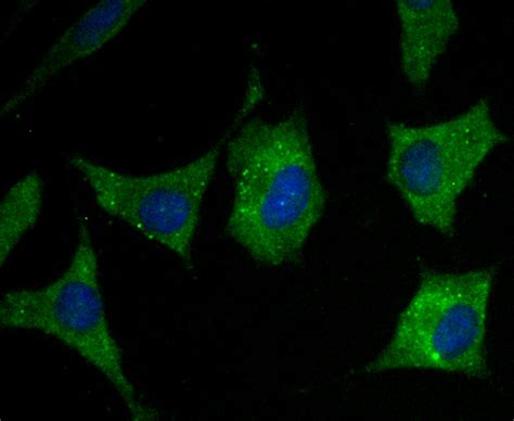 RYR2 Rabbit Polyclonal Antibody (ER1803-22) – HUABIO