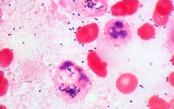 Streptococcus intermedius