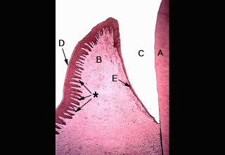 Oral Histology Digital Lab: Mucosa: Section Through the Gingiva (Image 7)