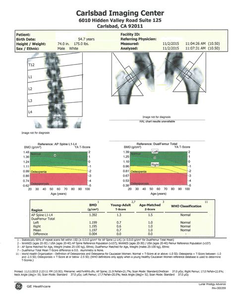 Bone Densitometry/DEXA scan - Carlsbad Imaging Center - Imperial Radiology