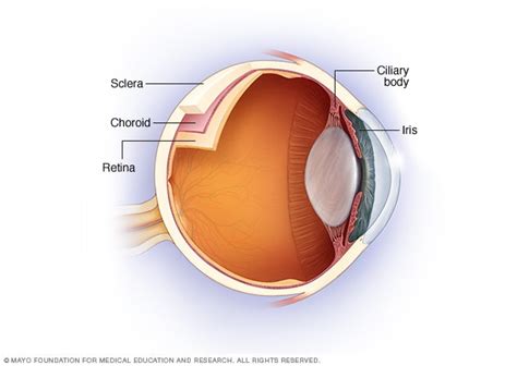 Uveitis - Symptoms and causes - Mayo Clinic