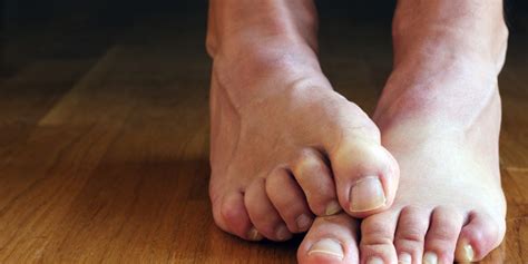 How to Fix Your Grossest Feet Problems | Men's Health