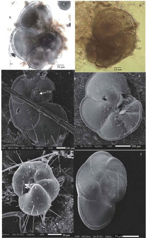 Light and scanning electron micrographs showing the discoid-shaped ...