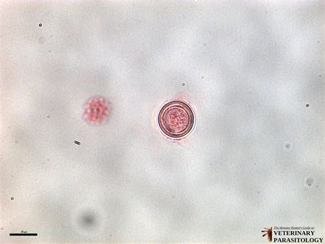 Echinococcus Granulosus Eggs, Wm Microscope Slide | ubicaciondepersonas ...