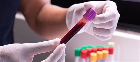 Why Do Blood Test Results Vary? | imaware