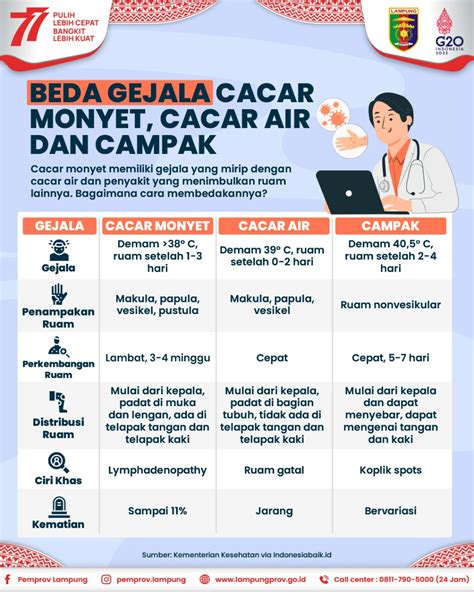 Beda Gejala Cacar Monyet, Cacar Air dan Campak - PPID Provinsi Lampung