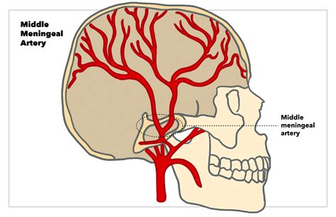 Neuroanatomy, Middle Meningeal Arteries Article