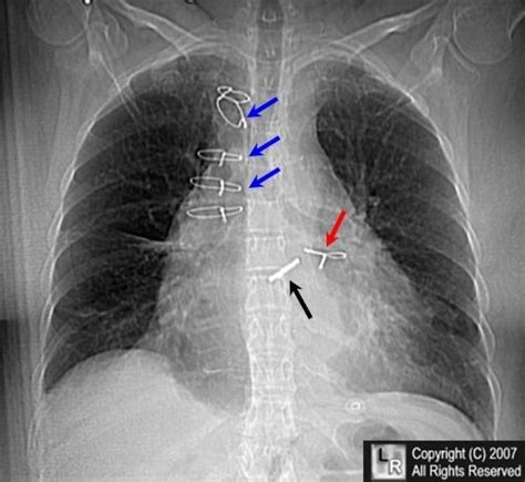 LearningRadiology | Medical knowledge, Medical, Radiology