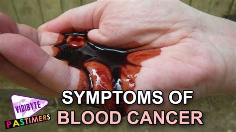 What are the Symptoms of Blood Cancer || Health Tips - YouTube