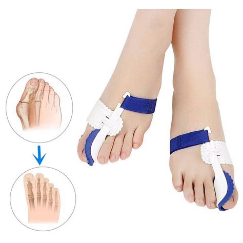 Orthopedic Bunion Corrector Splints - Non Surgical Treatment & Relief ...