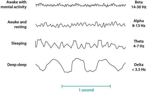 The Wave - The characteristics of an EEG — Firstclass