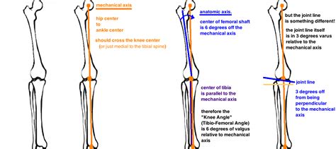 NATIVE KNEE ALIGNMENT — Hip & Knee Book