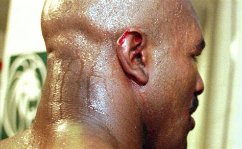 Whatever happened to missing piece of ear from Tyson-Holyfield ‘Bite ...