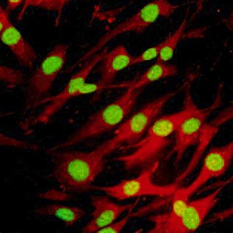 Human Skeletal Muscle Satellite Cells – cells-online.com