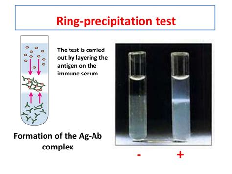 Antigen-antibody reactions and selected tests - online presentation