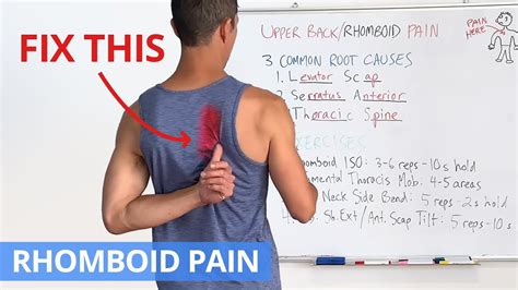 How to Fix Upper Back / Rhomboid Pain for GOOD (4 Effective Exercises ...