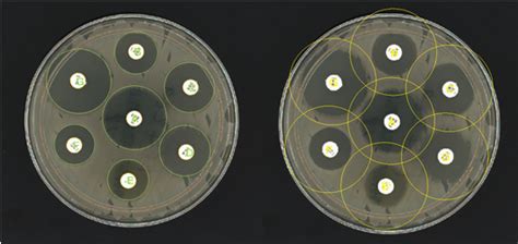 Antibiotic Susceptibility Testing (AST) - Synbiosis