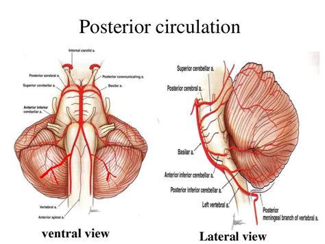 Posterior circulation stroke Syndromes