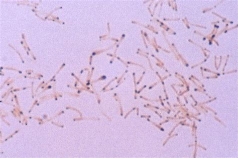 Corynebacterium Gram Stain