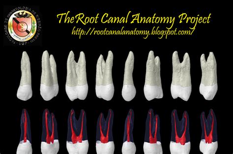 The Root Canal Anatomy Project: Maxillary First Premolar