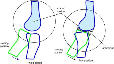 Figure 2 from The convex-concave rule and the lever law. | Semantic Scholar