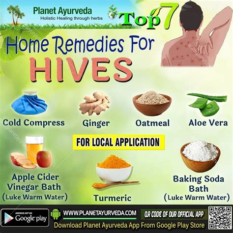 Hives In Babies Home Remedy - BABBIES CIP