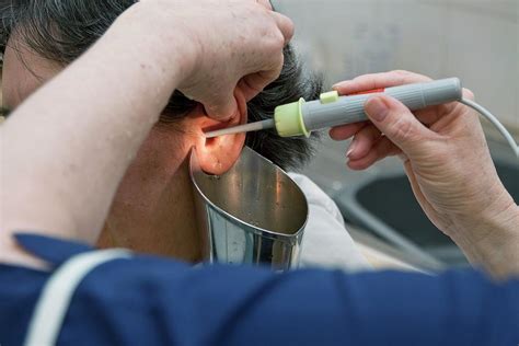 Ear Wax Removal Photograph by Life In View/science Photo Library