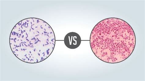 Gram Positive vs Gram Negative | Technology Networks