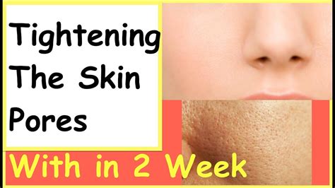 Tightening the skin pores | Home Remedies for Open Pores | how to close ...