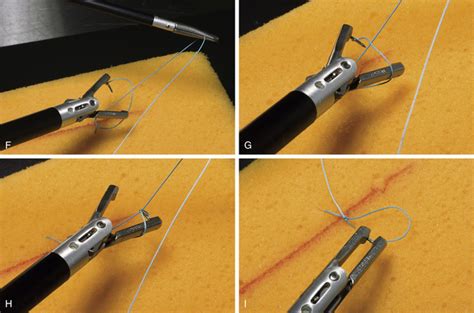 Endoscopic Knot Tying and Suturing | Veterian Key