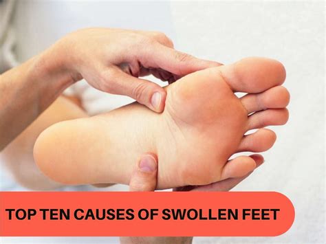 Swollen Feet: 10 Causes of Swollen Feet