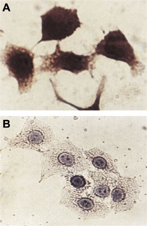 Illustration of cytokine production as represented by IL-8 on (A) and ...