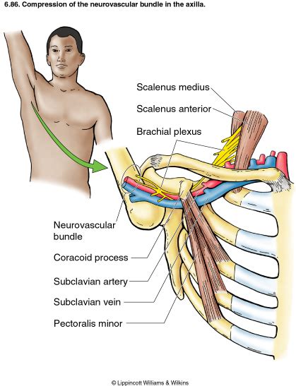 Thoracic Outlet Syndrome Tests Roos - Quotes Home