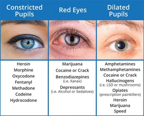 Pupil Size Chart Normal Range