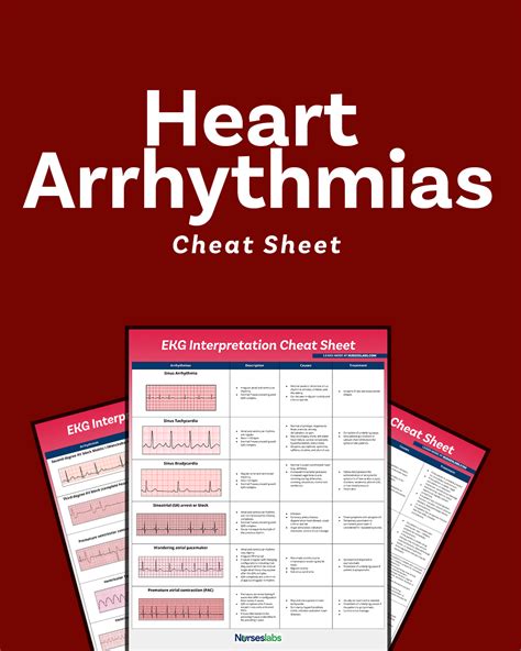 EKG Interpretation Cheat Sheet & Heart Arrhythmias Guide (2020 Update)