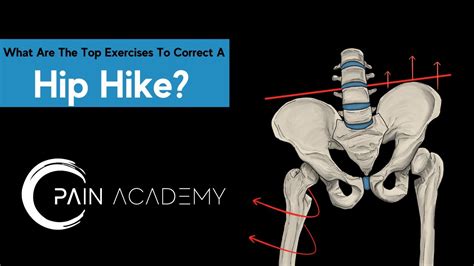 What Are The Top Exercises To Correct A Hip Hike? - YouTube