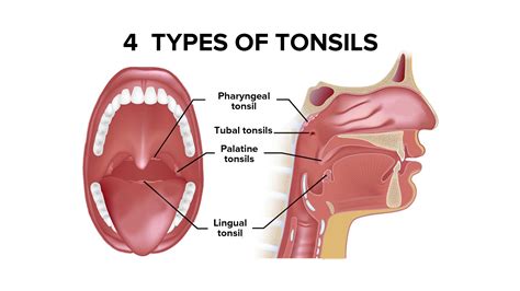 What are tonsils?